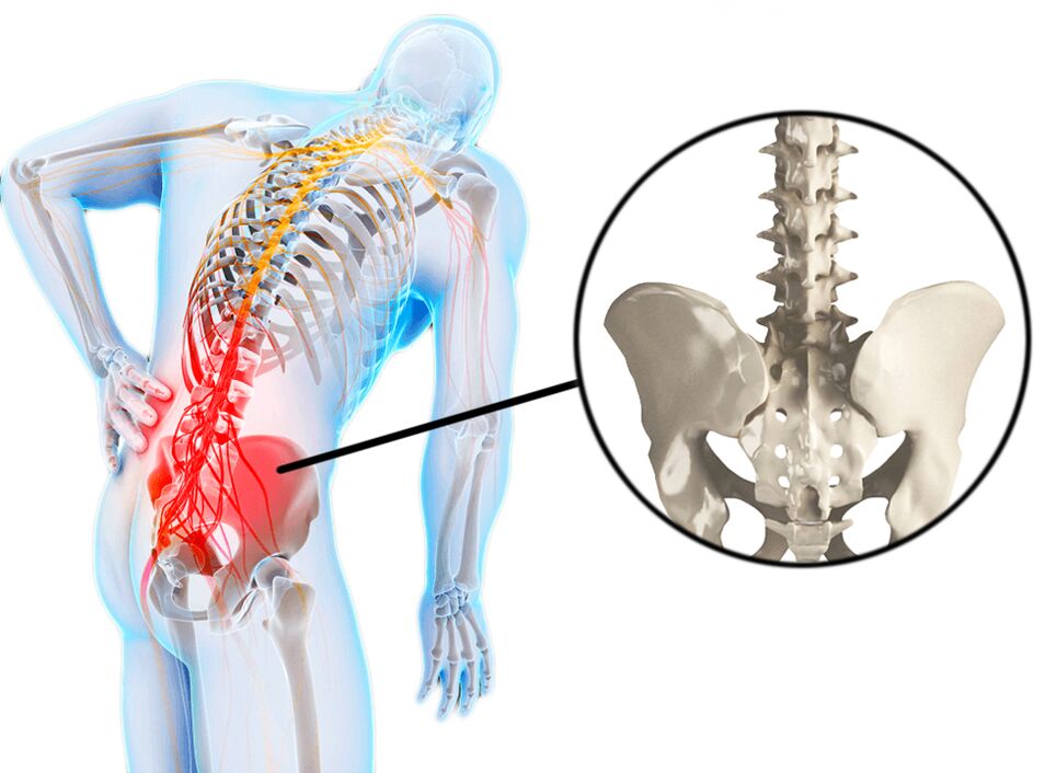 As patoloxías da columna vertebral son unha causa común de dor lumbar