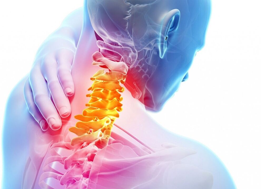 Que é a osteocondrose cervical