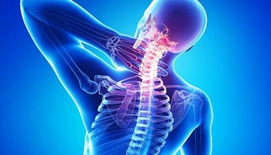 Complicacións da osteocondrose da columna cervical
