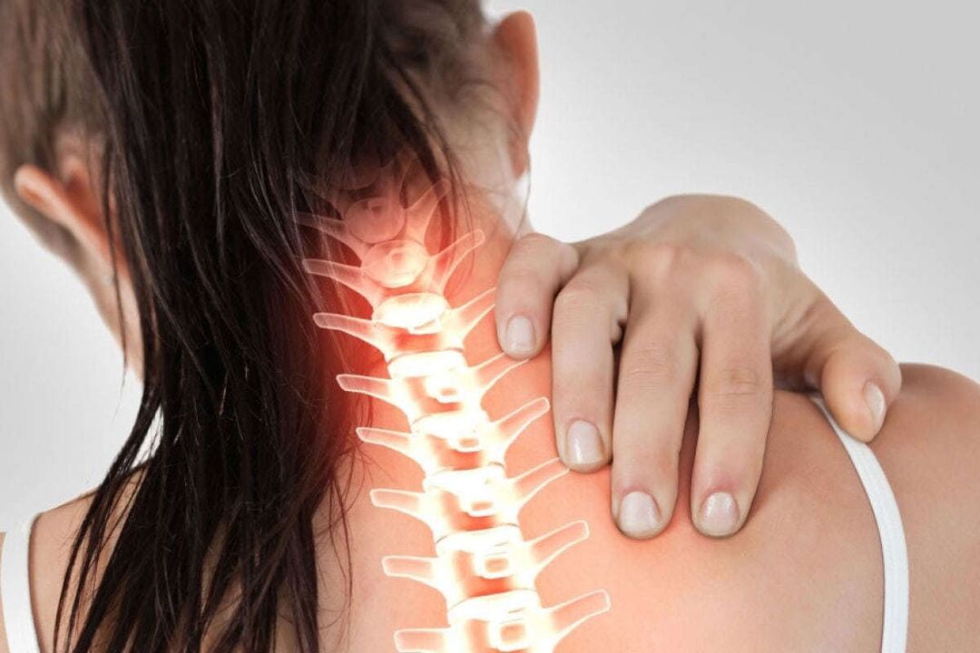 Manifestacións da osteocondrose cervical