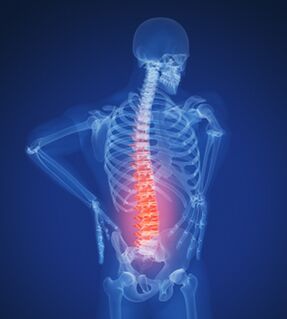 columna lumbar e osteocondrose